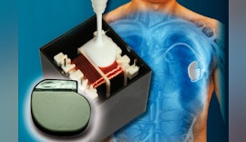 Höchste Präzision für Elektronik in der medizintechnischen Industrie